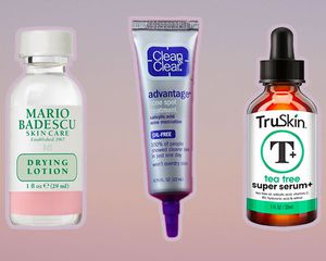 The 17 Best Acne Spot Treatments of 2022