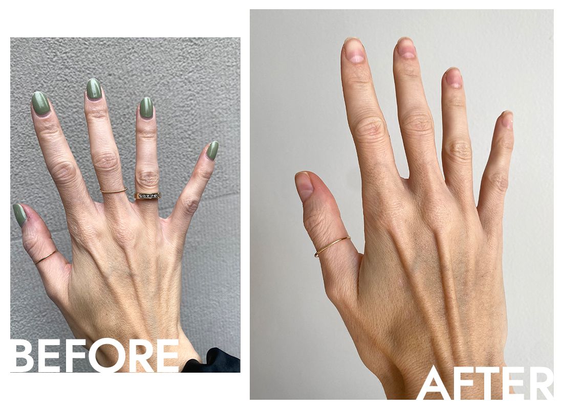 hannah baxter hands before and after