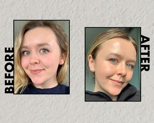 woman's niacinamide serum before and after photo 