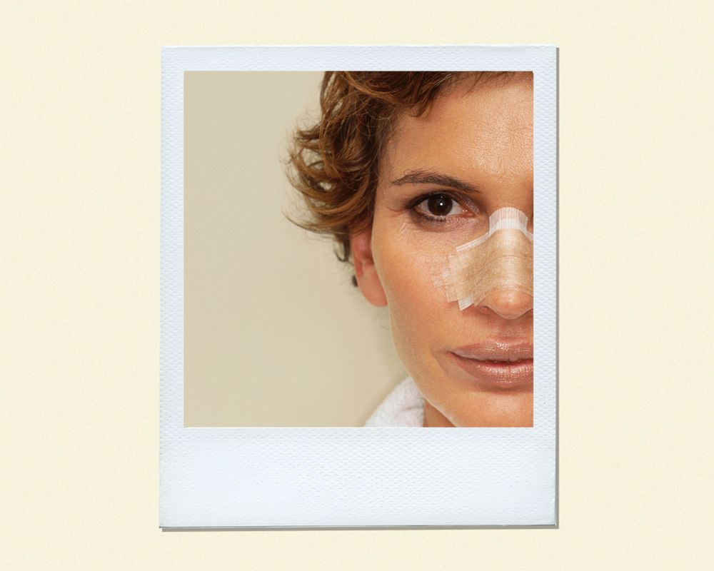 Up close of a woman with bandages on her nose